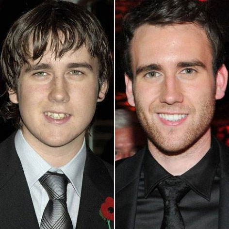 Matthew Lewis as a child and an adult. 